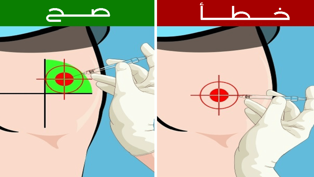 طريقة اعطاء حقن العضل , وماهي الاغراض التي يجب توافرها