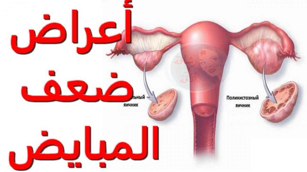 علاج ضعف البويضات 11528