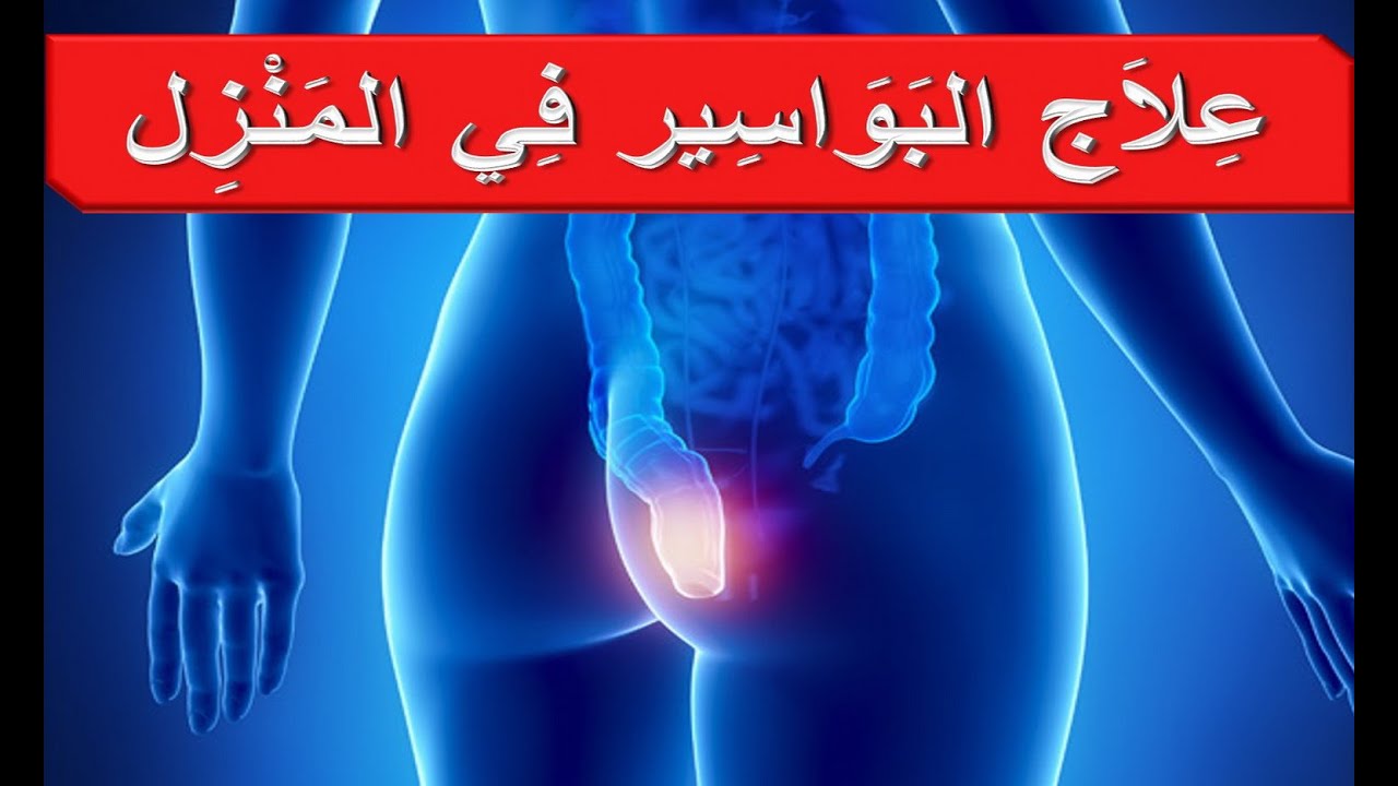 مرض البواسير - اعراض مرض البواسير 336 3