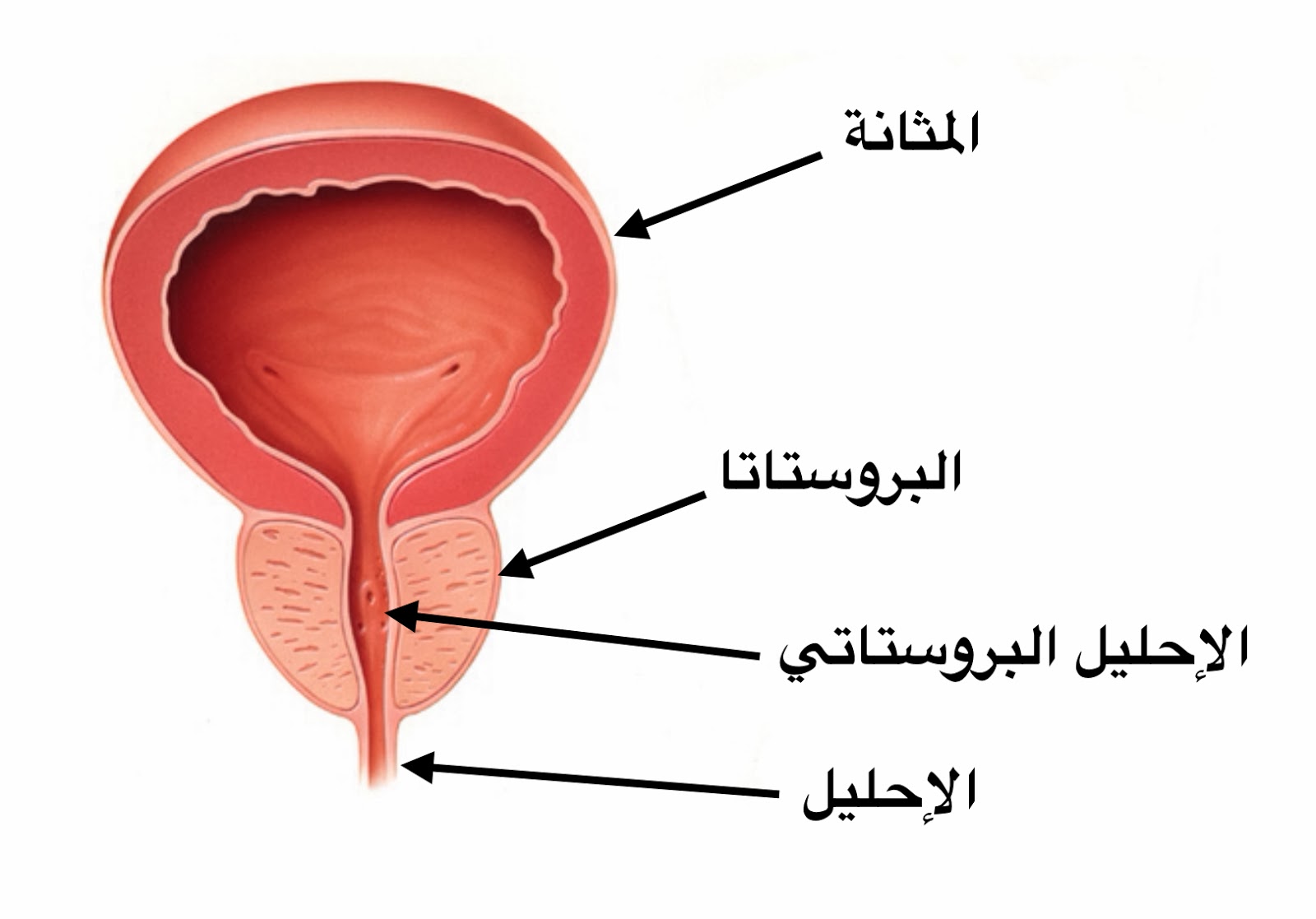 اسباب تضخم البروستاتا - ماهى الاسباب التي تؤدي الى الاصابة بامراض تضخم البروستاتا 5197 3