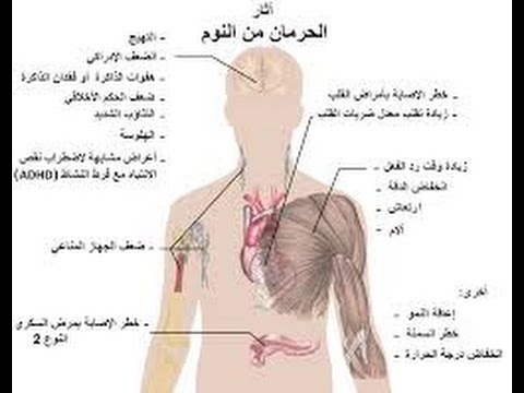 اسباب الارق - معلومات عن الارق 1928 2