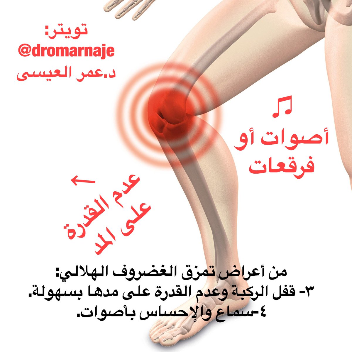 اعراض غضروف الركبة , كيفية العلاج من غضروف الركبه