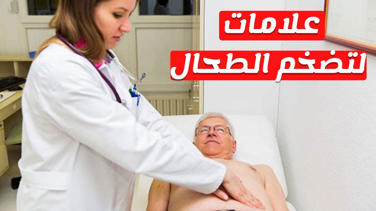 تضخم الطحال 4532