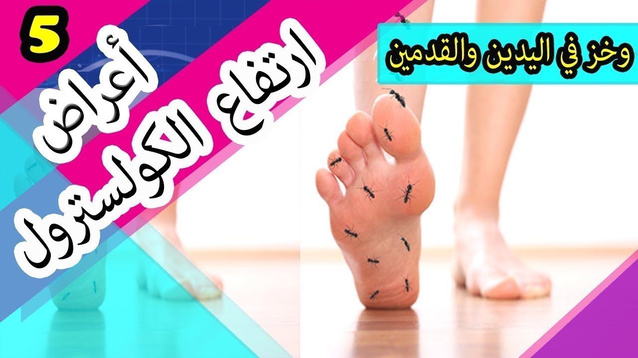 اعراض الكولسترول الضار 10934 3