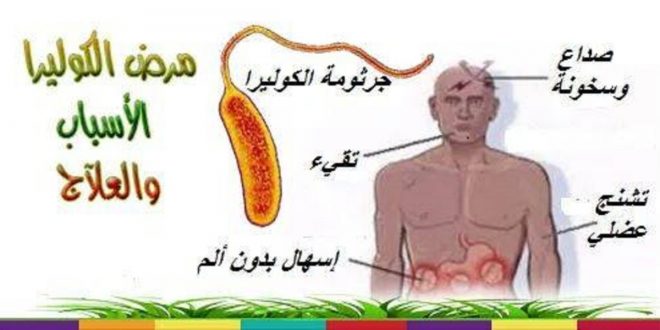 مرض الكوليرا - ماهو مرض الكوليرا 2841 3