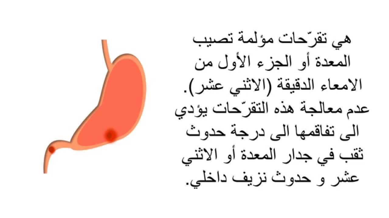 اعراض قرحة المعدة - تنتشر قرحه المعده بين كبار السن 5997 2