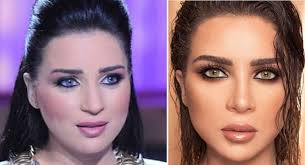 صور تجميل - عمليات التجميل و نتائجها 359 13