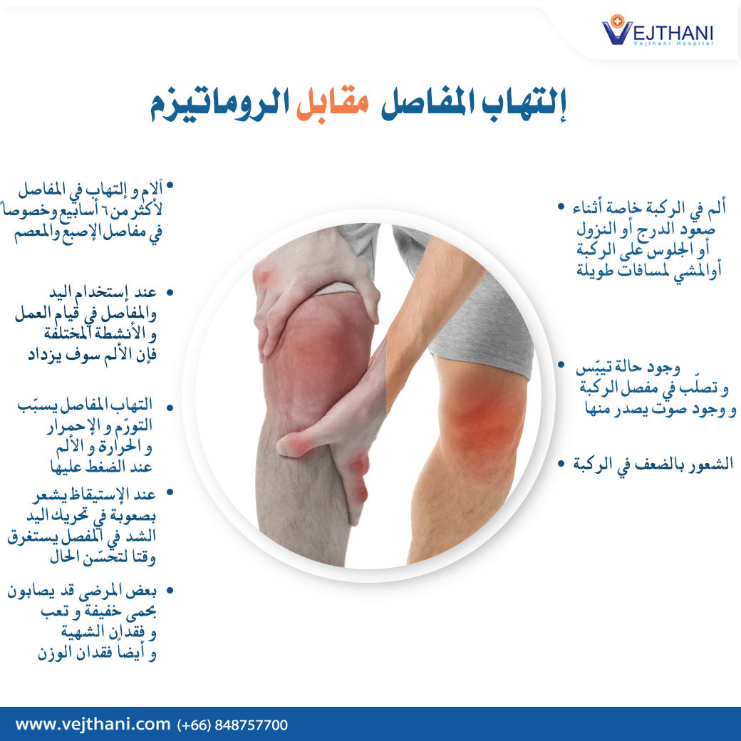 علاج الروماتيزم 4457 1