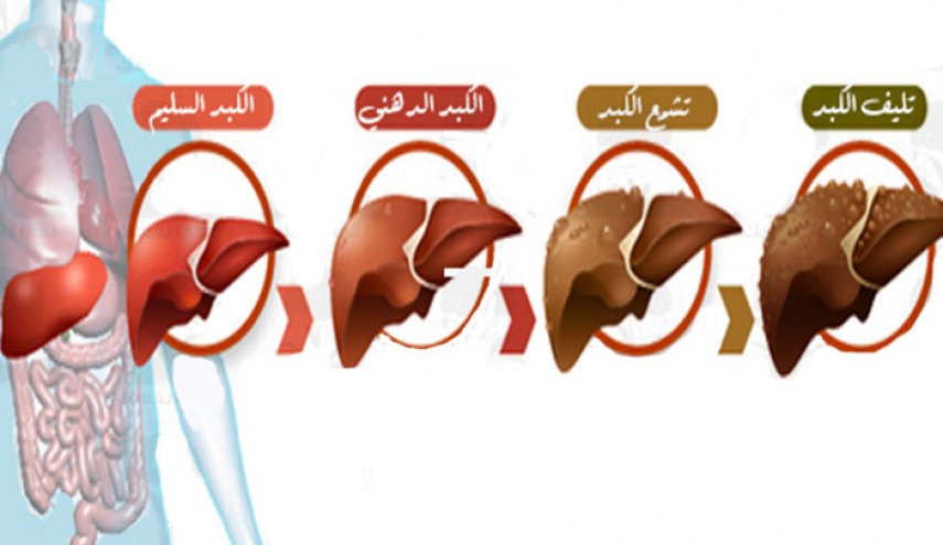 علامات امراض الكبد واعراضها - مشكلات الكبد واعراضها 416 3