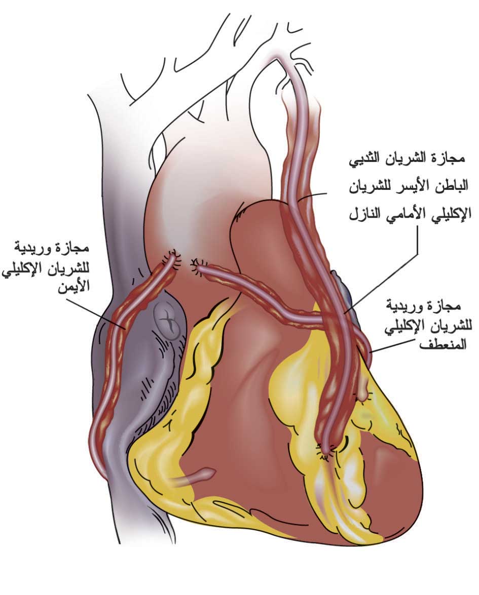 اعراض امراض القلب - ما هى عوارض مرض القلب 422 8