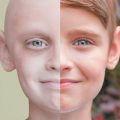 4772 2 علاج مرض السرطان - ماسبب مرض السرطان وجود عدلي