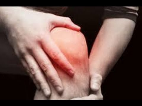 829 3 اعراض الروماتيزم - الاصابة بالتهاب المفاصل الروماتزمى شعاع حب