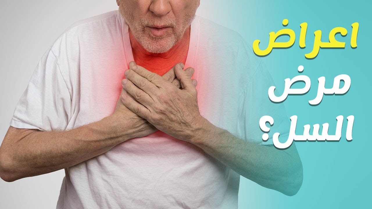 اعراض مرض السل المعوي - حقائق عن مرض السل 408 3