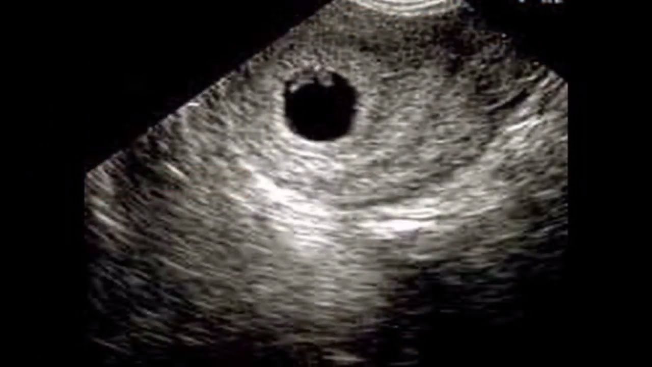 متى يظهر الجنين في كيس الحمل , تعرف عليه بالصور احلى كلام